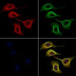 Arylsulfatase A Antibody in Immunocytochemistry (ICC/IF)