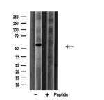 Arylsulfatase A Antibody in Western Blot (WB)