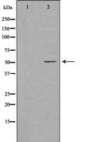 MMP8 Antibody in Western Blot (WB)