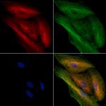 MFN1 Antibody in Immunocytochemistry (ICC/IF)