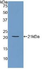 ARPC4 Antibody in Western Blot (WB)