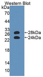 Orm1 Antibody in Western Blot (WB)