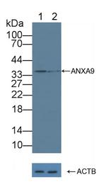 Annexin A9 Antibody in Western Blot (WB)