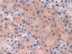 CD15 Antibody in Immunohistochemistry (Paraffin) (IHC (P))