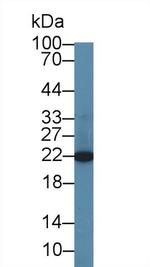 CBF beta Antibody in Western Blot (WB)