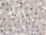 CTBS Antibody in Immunohistochemistry (Paraffin) (IHC (P))