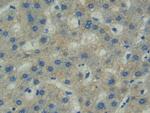 FAK Antibody in Immunohistochemistry (Paraffin) (IHC (P))