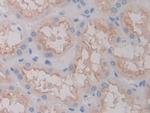 FOLR1 Antibody in Immunohistochemistry (Paraffin) (IHC (P))