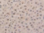 GSTA5 Antibody in Immunohistochemistry (Paraffin) (IHC (P))