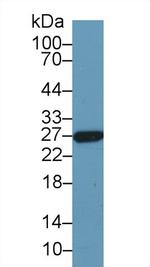 GSTA5 Antibody in Western Blot (WB)