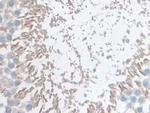 GSTM4 Antibody in Immunohistochemistry (Paraffin) (IHC (P))