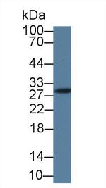 GSTM4 Antibody in Western Blot (WB)