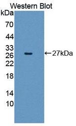 GSTM4 Antibody in Western Blot (WB)