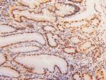 hnRNP A2B1 Antibody in Immunohistochemistry (Paraffin) (IHC (P))