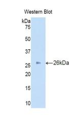 Iduronate 2 Sulfatase Antibody in Western Blot (WB)