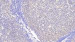 INPP4A Antibody in Immunohistochemistry (Paraffin) (IHC (P))