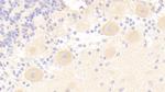 IRS2 Antibody in Immunohistochemistry (Paraffin) (IHC (P))