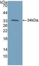 KATNA1 Antibody in Western Blot (WB)