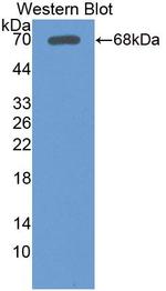 LSR Antibody in Western Blot (WB)