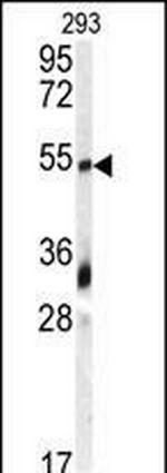 GDF10 Antibody in Western Blot (WB)