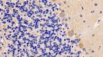 OSMR Antibody in Immunohistochemistry (Paraffin) (IHC (P))