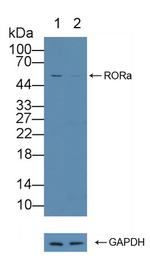 RORA Antibody in Western Blot (WB)