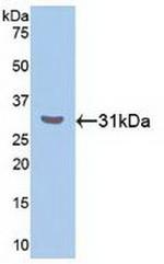 RORA Antibody in Western Blot (WB)