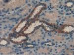 RBP1 Antibody in Immunohistochemistry (Paraffin) (IHC (P))