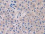 SLIT1 Antibody in Immunohistochemistry (Paraffin) (IHC (P))