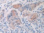 SLIT1 Antibody in Immunohistochemistry (Paraffin) (IHC (P))