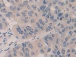 SMC3 Antibody in Immunohistochemistry (Paraffin) (IHC (P))