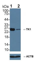 TK1 Antibody in Western Blot (WB)