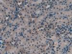 KNT1 Antibody in Immunohistochemistry (Paraffin) (IHC (P))