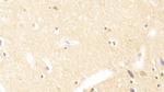 TUBB1 Antibody in Immunohistochemistry (Paraffin) (IHC (P))