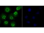 Fyn Antibody in Immunocytochemistry (ICC/IF)