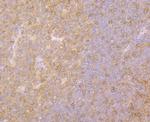 Fyn Antibody in Immunohistochemistry (Paraffin) (IHC (P))