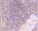 Fyn Antibody in Immunohistochemistry (Paraffin) (IHC (P))