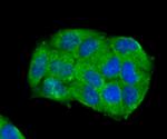 Carbonic anhydrase II Antibody in Immunocytochemistry (ICC/IF)