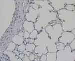 Galectin 3 Antibody in Immunohistochemistry (Paraffin) (IHC (P))
