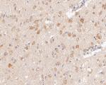 SYNDIG1 Antibody in Immunohistochemistry (Paraffin) (IHC (P))