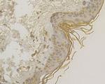 PKP3 Antibody in Immunohistochemistry (Paraffin) (IHC (P))