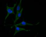 Munc13-4 Antibody in Immunocytochemistry (ICC/IF)