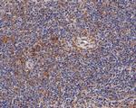 Munc13-4 Antibody in Immunohistochemistry (Paraffin) (IHC (P))