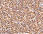 PPP1R9A Antibody in Immunohistochemistry (Paraffin) (IHC (P))