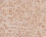 PPP1R9A Antibody in Immunohistochemistry (Paraffin) (IHC (P))