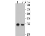 ZFHX3 Antibody in Western Blot (WB)