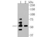 ZIC2 Antibody in Western Blot (WB)