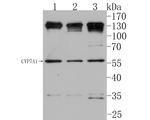 CYP7A1 Antibody in Western Blot (WB)