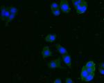 INHA Antibody in Immunocytochemistry (ICC/IF)
