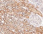 P-Glycoprotein Antibody in Immunohistochemistry (Paraffin) (IHC (P))